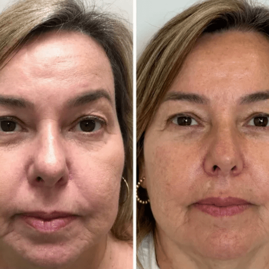 Collagen Fit - Máscara de Colagénio - Comprar em Bello Sconto