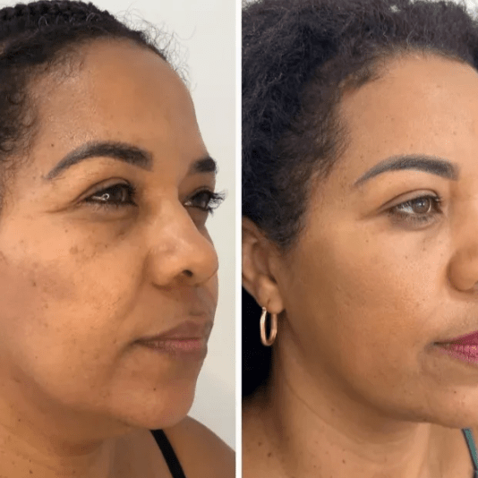 Collagen Fit - Máscara de Colagénio - Comprar em Bello Sconto