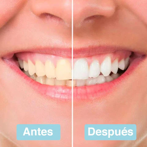 TIRAS BLANQUEADORAS DENTALES DE COCO - PEARLSHINE™