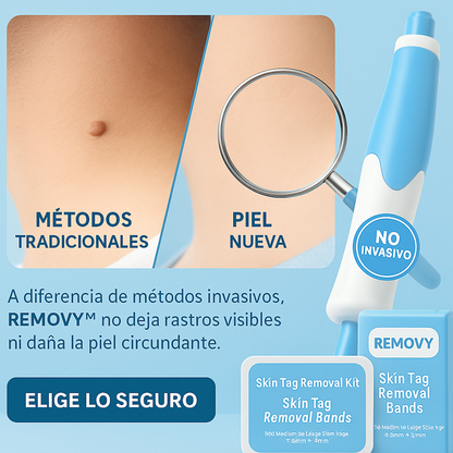 KIT COMPLETO ELIMINADOR DE ACROCORDONES - REMOVY™
