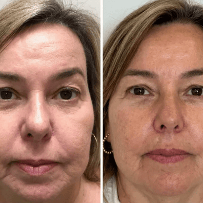 Collagen Fit - Máscara de Colagénio - Comprar em Bello Sconto