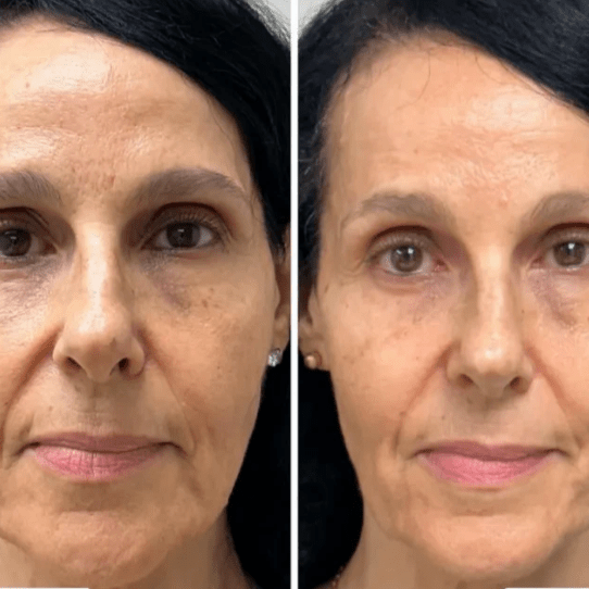 Collagen Fit - Máscara de Colagénio - Comprar em Bello Sconto