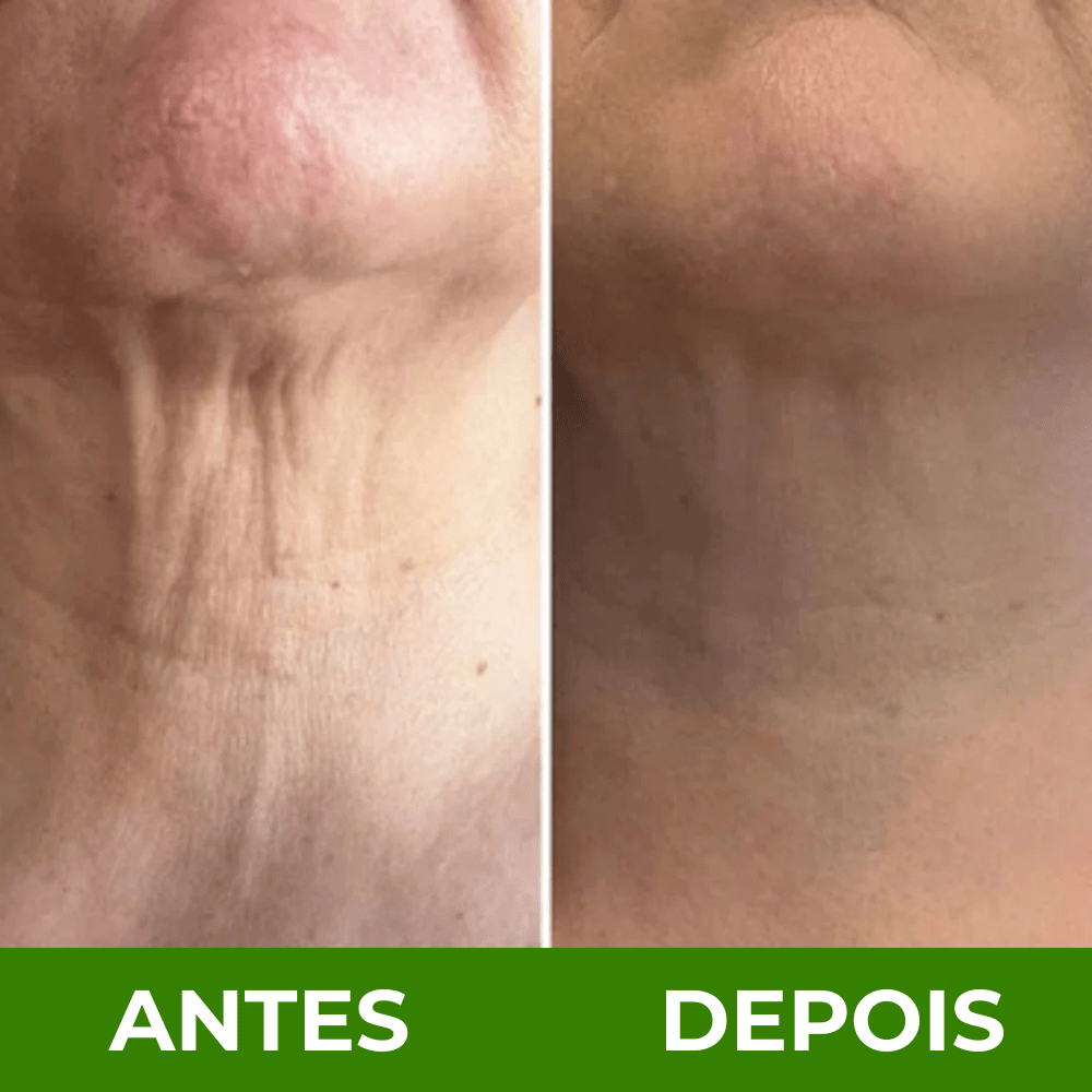 Creme ah - 8 botox 3 em 1 com rolo reafirmante para queixo, pescoço e papada - Comprar em Bello Sconto