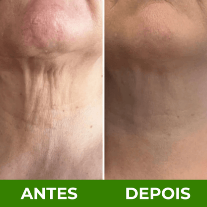 Creme ah - 8 botox 3 em 1 com rolo reafirmante para queixo, pescoço e papada - Comprar em Bello Sconto